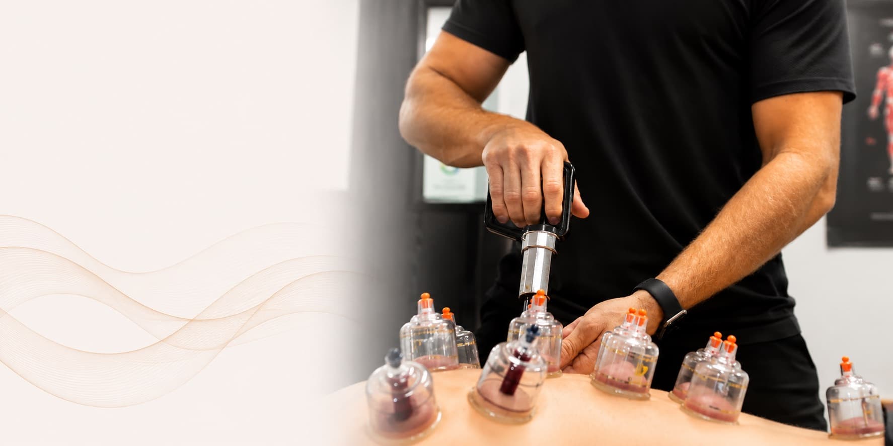 Cupping therapy session at Aligned Health