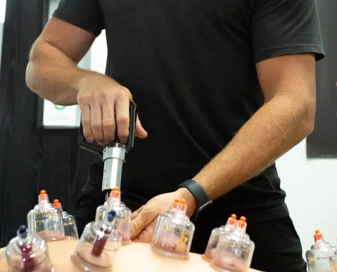 Cupping therapy session at Aligned Health